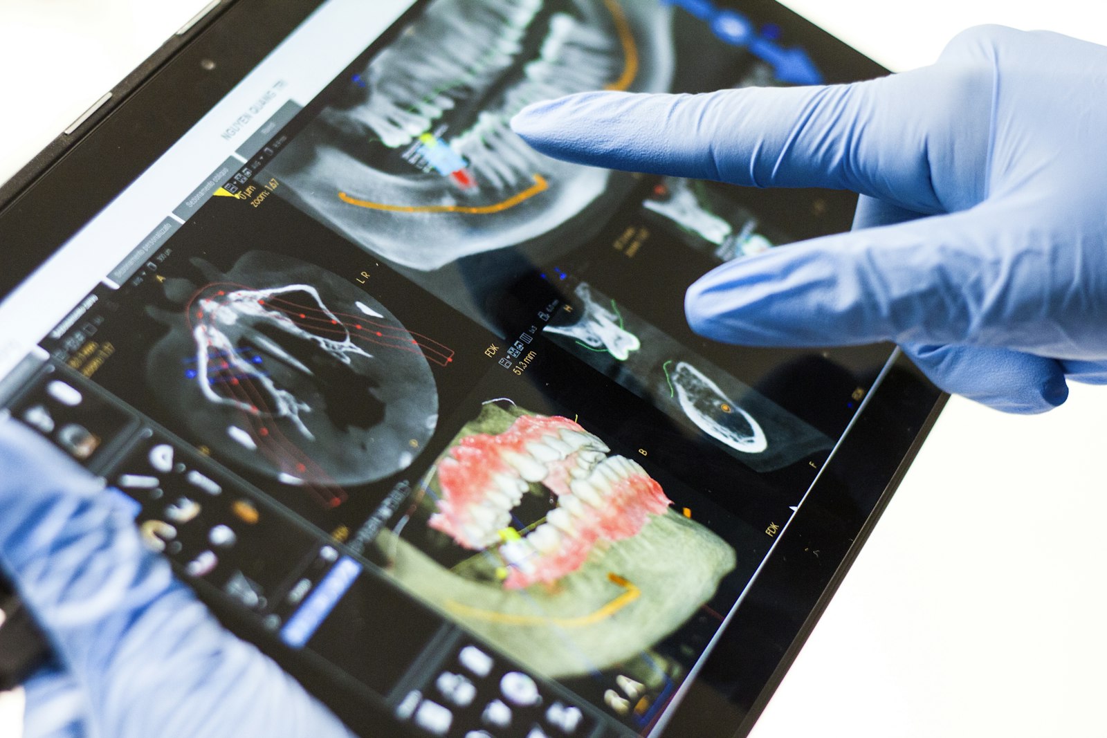 Advanced Treatment Coordination & Case Acceptance (Level 3)